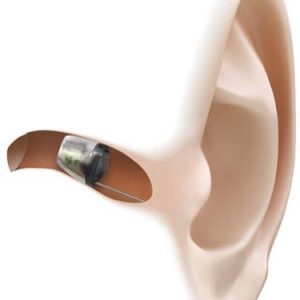 hearing-aids-adelaide